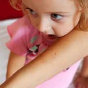 Mordidas Infantiles: cómo entender y corregir este comportamiento