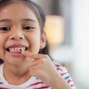 Qué pasa cuando no se caen los dientes de leche