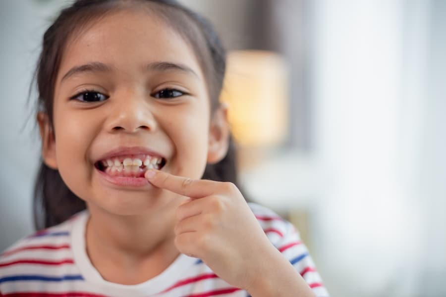 Qué pasa cuando no se caen los dientes de leche