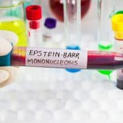 Mononucleosis infantil: señales de alerta y cuidados