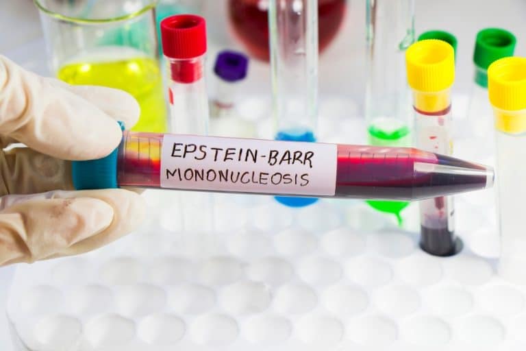 Mononucleosis infantil: señales de alerta y cuidados