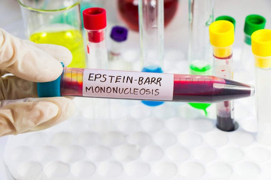 Mononucleosis infantil: señales de alerta y cuidados